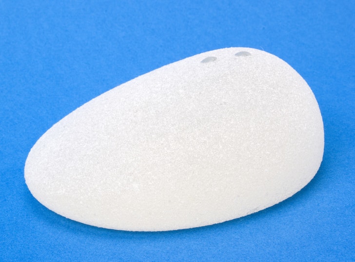 Implant mammaire anatomique vu de profil, en forme de goutte d’eau